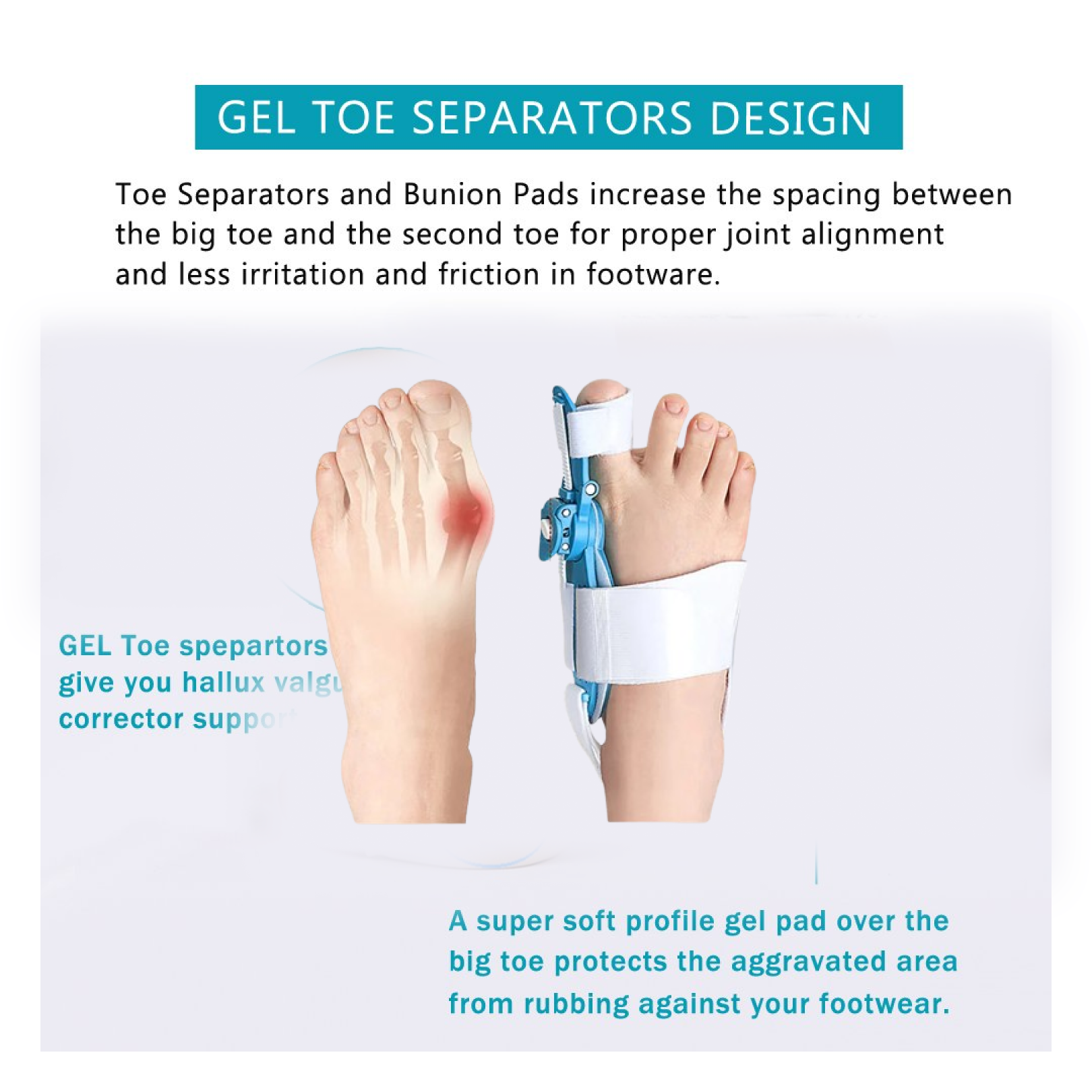 Adjustable Bunion Support Splint – Hallux Valgus Corrector for Men & Women