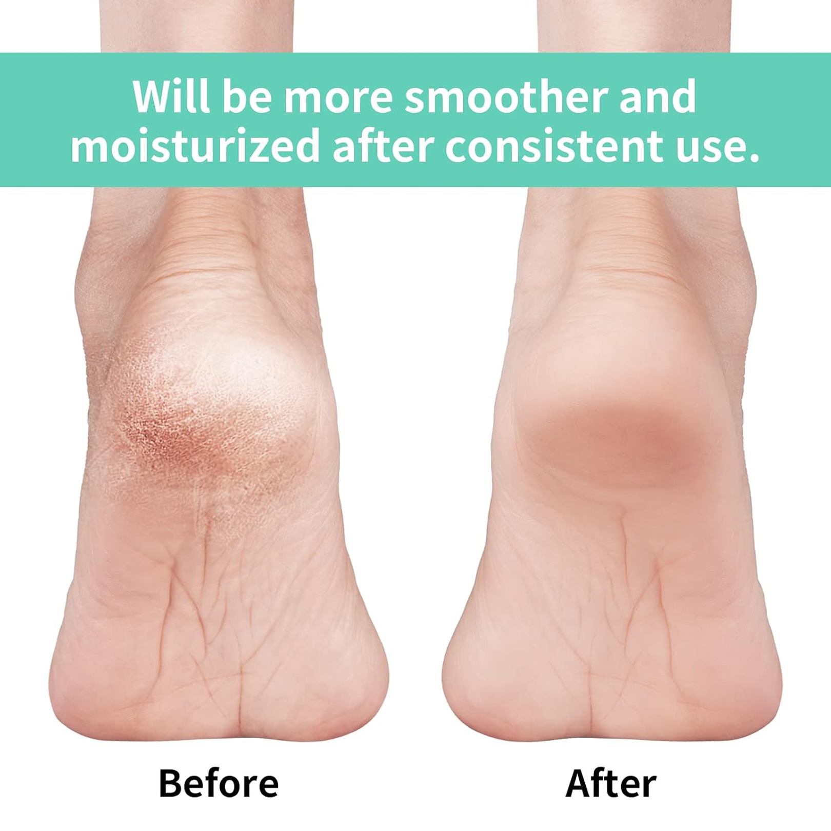 Anti Crack Silicon Gel Heel Moisturizing Socks for Foot Care Men Women (Loose Pack)